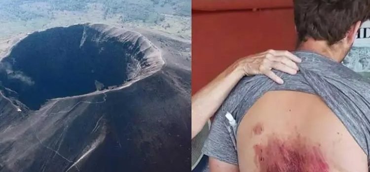 Cayó turista en el cráter del Vesubio
