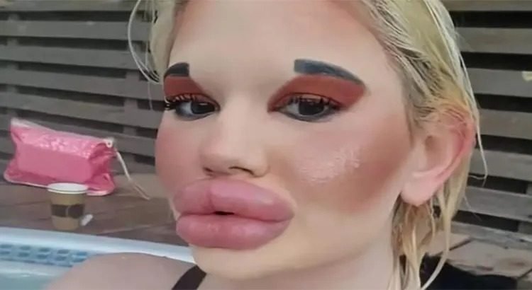 Tiene los labios más grandes