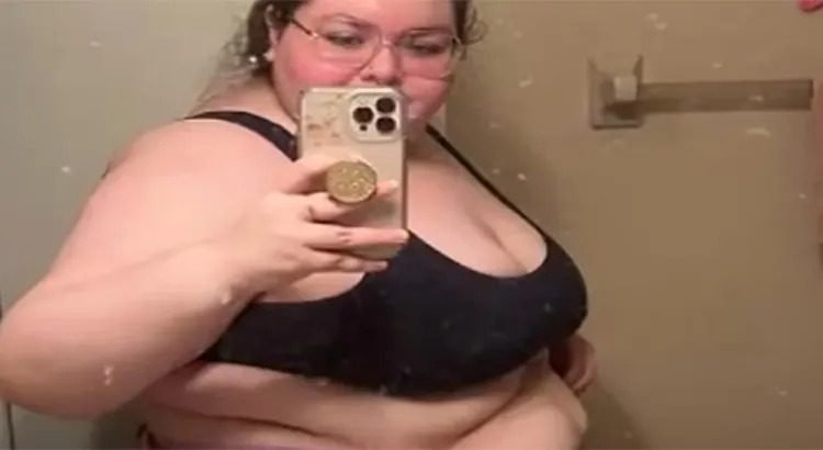 Creía que era obesidad y nada más