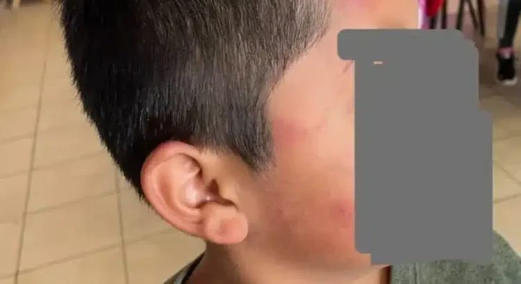 Suspenden clases en primarias de Tlaquilpa por contagio masivo con el virus Coxsackie